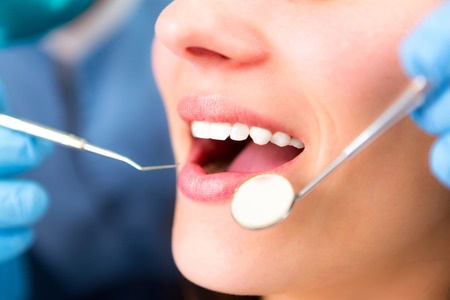 Common Dental Myths Exposed