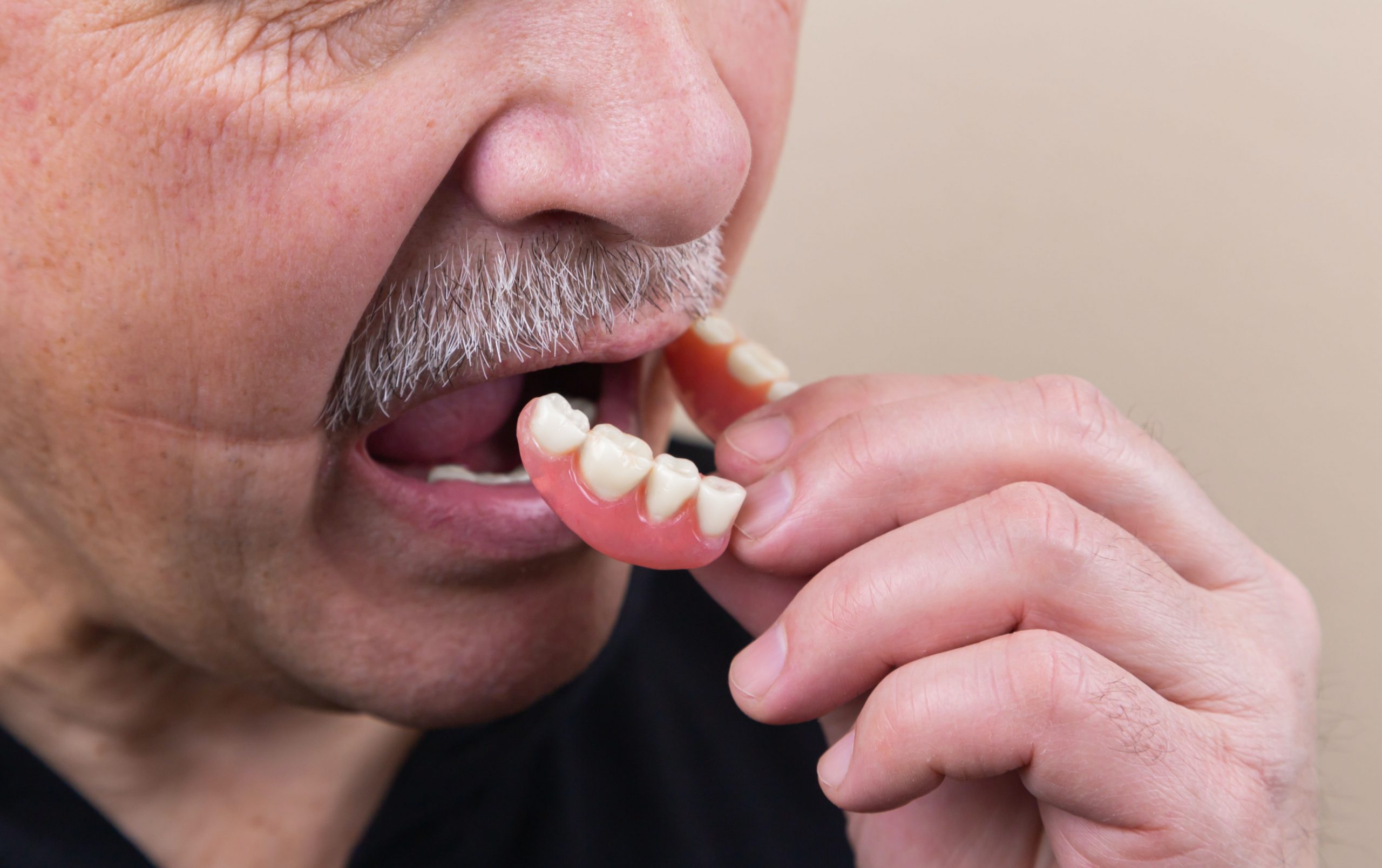 Debunking Dental Myths: Discover 4 Truths About Dentures