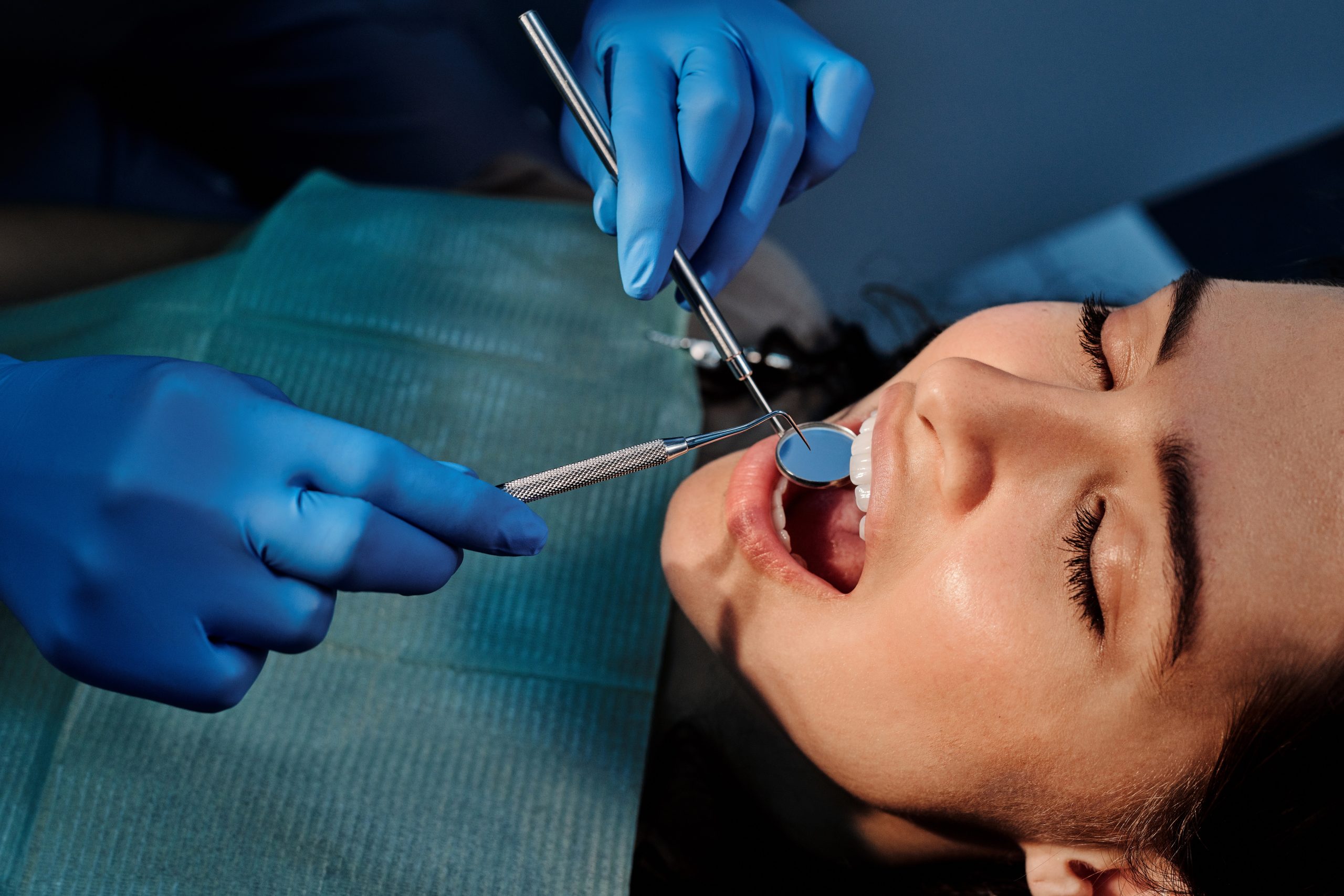 5 Common Signs You Might Need to See a Root Canal Dentist