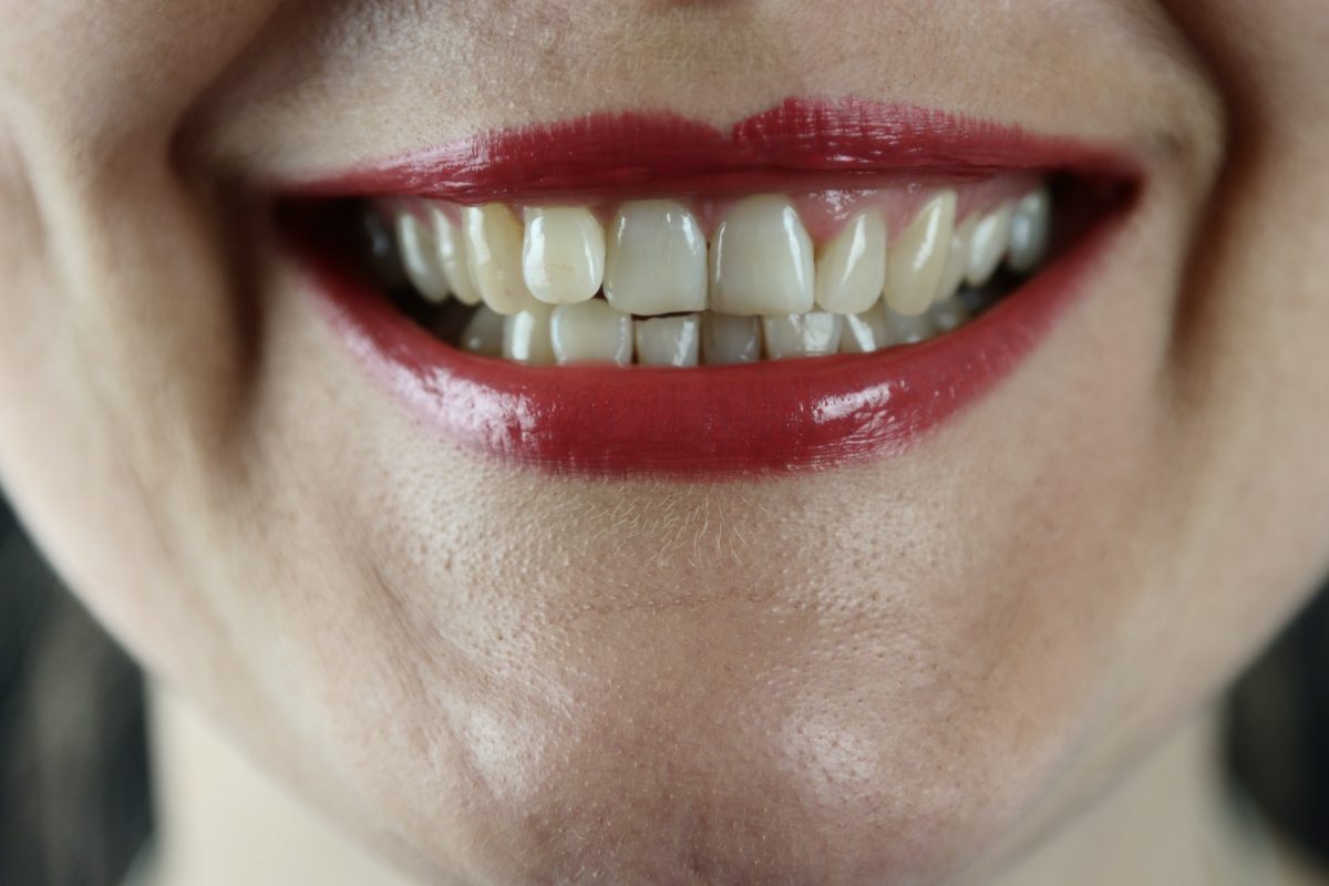 Debunking Myths About Keeping Your Teeth White