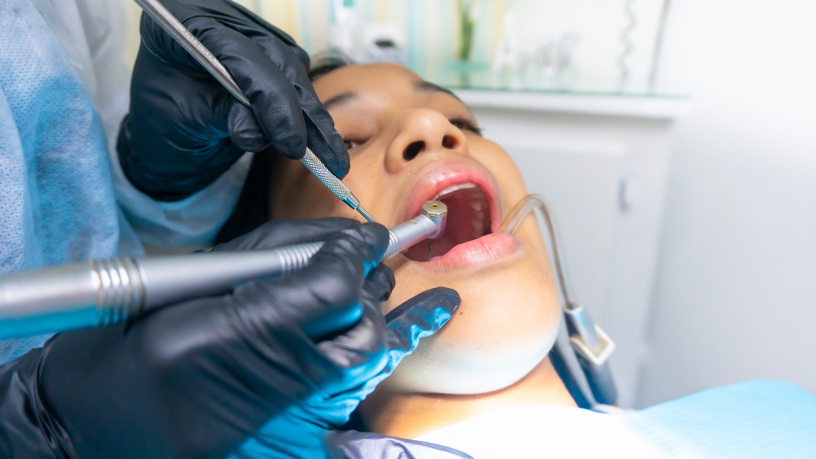 5 Advantages of Root Canal Treatment You Should Know About